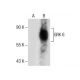 western blotting image from recommended GRK 6 (D-10) monoclonal antibody replacement. Image 285050