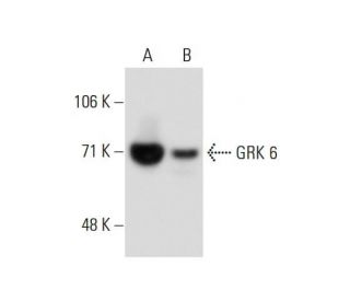 GRK 6 Antibody (XX-4) - Western Blotting - Image 134891 