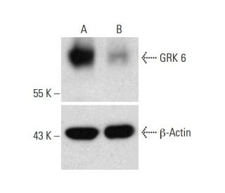GRK 6 CRISPR/CAS9 KO Plasmid (h): sc-402061. Western blot analysis of GRK 6 expression in empty vector control (A) and GRKEach CRISPR/Cas9 Knockout (KO) Plasmid product consists of a pool of 3 plasmids designed to ensure identification and cleavage of a specific gene for maximum knockout efficiency. Each plasmid encodes a unique 20 nt sequence derived from the GeCKO (v2) library.