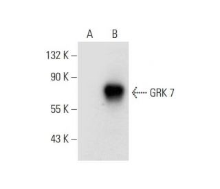 GRK 7 Antibody (C-2) - Western Blotting - Image 304309 