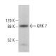 GRK 7 Antibody (C-2) - Western Blotting - Image 375587