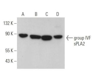 group IVF sPLA<sub>2</sub> Antibody (C-6) - Western Blotting - Image 369919 