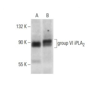 group VI iPLA<sub>2 Antibody (</sub>A-10) - Western Blotting - Image 303813 
