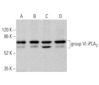 group VI iPLA<sub>2</sub> Antibody (E-8) - Western Blotting - Image 373595 