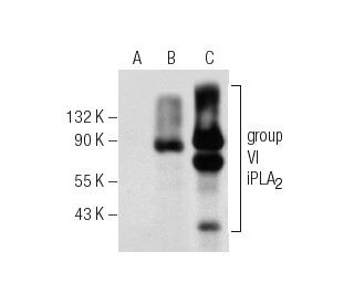 western blotting image from recommended group VI iPLA2 (D-4) monoclonal antibody replacement. Image 156421