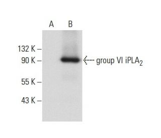 group VI iPLA<sub>2 Antibody (</sub>A-10) - Western Blotting - Image 59622