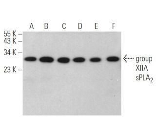 group XIIA sPLA<sub>2</sub> Antibody (E-9) - Western Blotting - Image 371694 