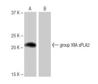 group XIIA sPLA<sub>2</sub> Antibody (SP-34) - Western Blotting - Image 64953