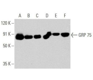 western blotting image from recommended GRP 75 (D-9) monoclonal antibody replacement. Image 356183