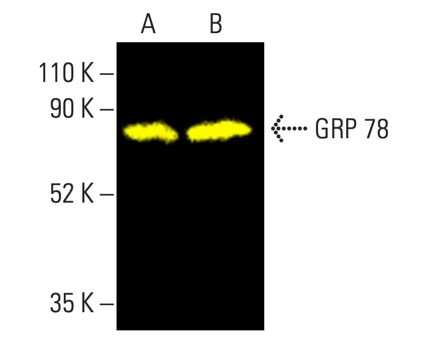 HSPA5/BiP/GRP78 Antibody (E-4) | SCBT - Santa Cruz Biotechnology