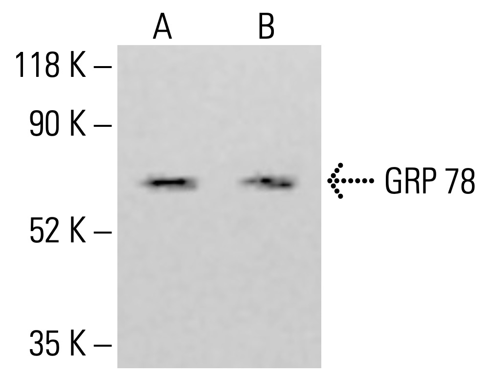 HSPA5/BiP/GRP78 Antibody (E-4) | SCBT - Santa Cruz Biotechnology