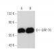 western blotting image from recommended HSPA5/BiP/GRP78 (E-4) monoclonal antibody replacement. Image 82274