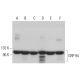 This polyclonal antibody has been discontinued. See our recommended <a href="grp-94-antibody-9g10">GRP 94 (9G10)</a> monoclonal antibody (sample data shown). western blotting image from recommended GRP 94 (9G10) monoclonal antibody replacement. Image 380885
