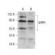 GRPR Antibody (F-6) - Western Blotting - Image 381466 