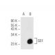 GS1 Antibody (D-6) - Western Blotting - Image 81182