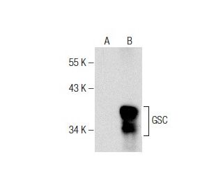 western blotting image from recommended GSC (L-36) monoclonal antibody replacement. Image 282074