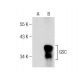 western blotting image from recommended GSC (L-36) monoclonal antibody replacement. Image 282074