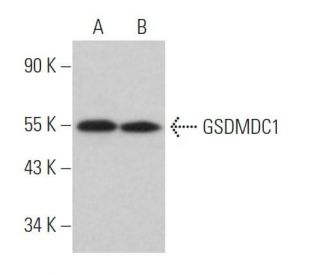 GSDMDC1 Antibody (A-7)