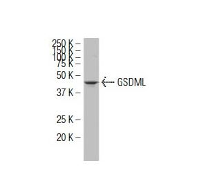 GSDML Antibody (3D8) - Western Blotting - Image 34598 