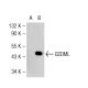 GSDML Antibody (3D8) - Western Blotting - Image 126617 