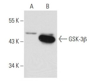 GSK-3&beta; Antibody (1F7) - Western Blotting - Image 42979 