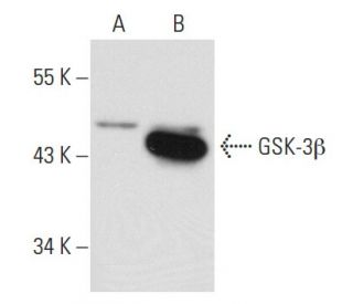 GSK3 beta Antibody (1F7) - Western Blotting - Image 42979 