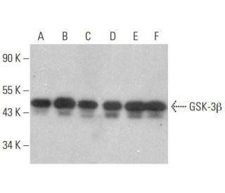 Anti Gsk 3b Antibody E 11 Scbt Santa Cruz Biotechnology