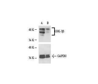 GSK-3 beta siRNA (h): sc-35527. Western blot analysis of GSK-3 beta expression... 