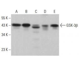 GSK3 beta Antibody (E-11) - Western Blotting - Image 380201