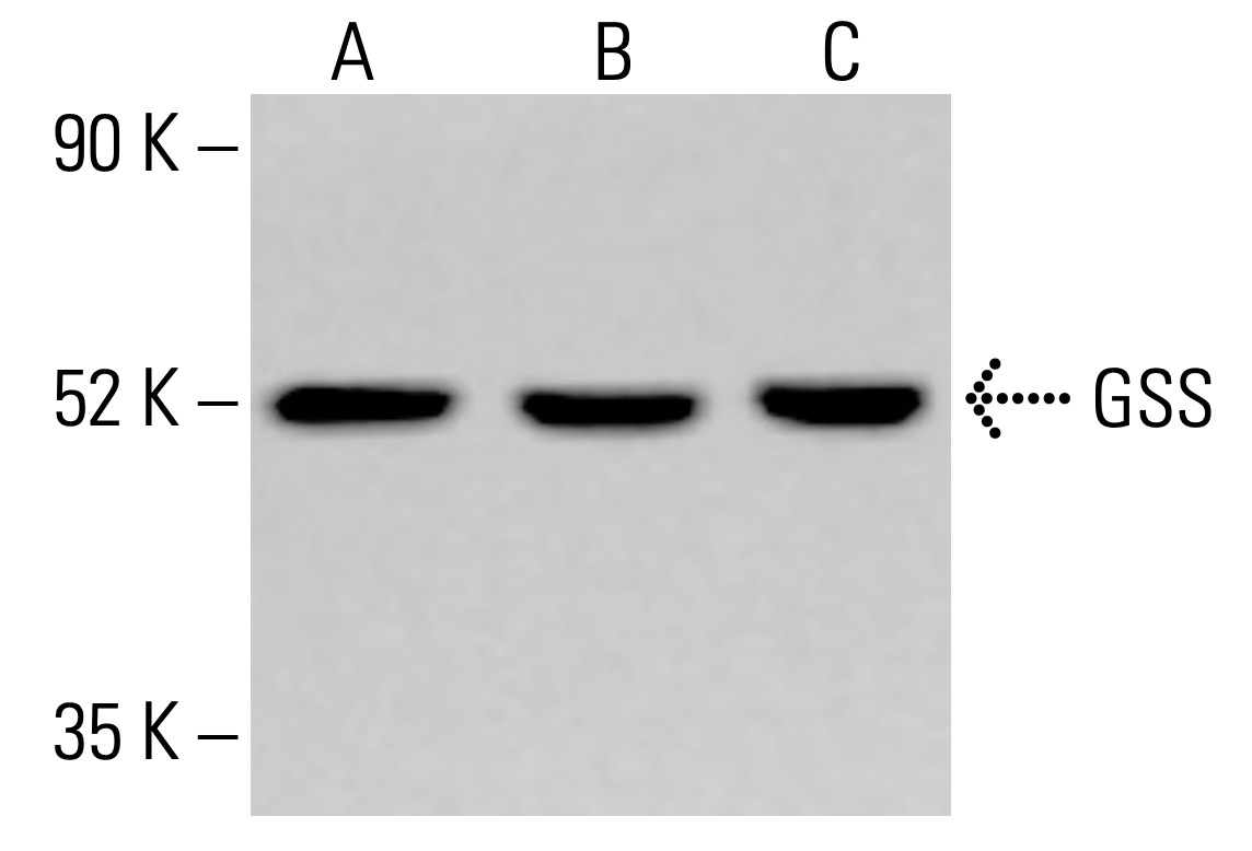 glutathione antibody santa cruz GSS (H-7) | SCBT Size:90ct Dr. Lacir Vien Nam Eye cream for reducing fine lines