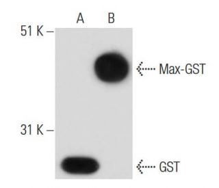 GST Antibody (S-tag-05) - Western Blotting - Image 15628