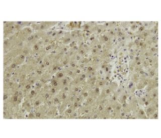 GSTA1 Antibody (R-14) - Immunohistochemistry - Image 36065 