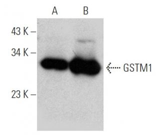 GSTM1 Antibody (1H4F2) - Western Blotting - Image 368284 