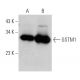 GSTM1 Antibody (1H4F2) - Western Blotting - Image 368284 