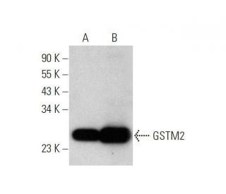 GSTM2 Antibody (E-9) - Western Blotting - Image 353430 