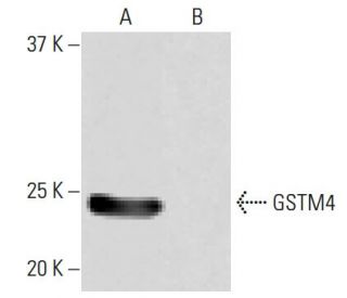 GSTM4 Antibody (PL-B12) - Western Blotting - Image 64954The Double Nickase Plasmid features a U6 promoter for sgRNA expression, a 20 nt targeting sequence, and a gRNA scaffold to guide Cas9n. It includes a CBh promoter for Cas9n (D10A) and puromycin resistance, GFP for transfection verification, and nuclear localization signals (NLS). The 2A peptide allows co-expression of Cas9n and Puro from a single promoter, enabling precise genome editing with reduced off-target effects.