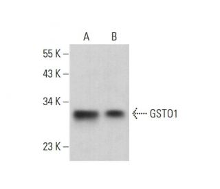 GSTO1 Antibody (21) - Western Blotting - Image 382091