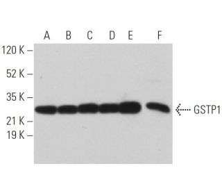 western blotting image from recommended GSTP1 (3F2C2) monoclonal antibody replacement. Image 373487