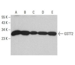 GSTT2 Antibody (D-1) - Western Blotting - Image 376724 