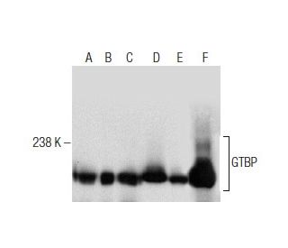 western blotting image from recommended GTBP (E-8) monoclonal antibody replacement. Image 164447