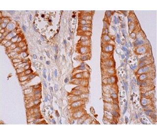 GW182 Antibody (2D6) - Immunohistochemistry - Image 293280