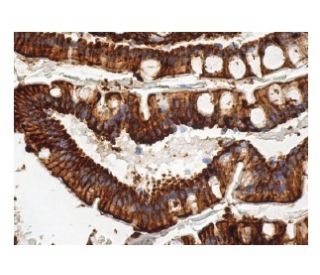 GW182 Antibody (4B6) - Immunohistochemistry - Image 156850