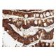 GW182 Antibody (4B6) - Immunohistochemistry - Image 156850