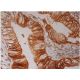 GW182 Antibody (A-8) - Immunohistochemistry - Image 286496 