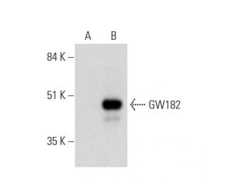 GW182 Antibody (F-8) - Western Blotting - Image 331164