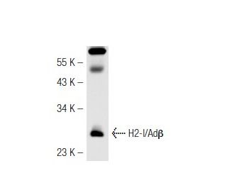 H2-I/Ad&beta; Antibody (34-5-3) - Western Blotting - Image 43005