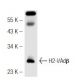 H2-I/Adβ Antibody (34-5-3) - Western Blotting - Image 43005