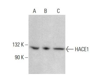 HACE1 Antibody (C-9) - Western Blotting - Image 377461SAM Transcription Activation: SAM system utilizing dCas9-VP64, MS2-P65-HSF1, and sgRNA for precise gene transcription activation.