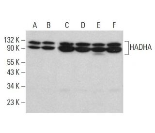 HADHA Antibody (E-8) - Western Blotting - Image 381781Each CRISPR/Cas9 Knockout (KO) Plasmid product consists of a pool of 3 plasmids designed to ensure identification and cleavage of a specific gene for maximum knockout efficiency. Each plasmid encodes a unique 20 nt sequence derived from the GeCKO (v2) library.