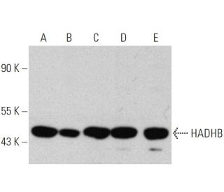HADHB Antibody (C-6) - Western Blotting - Image 359953 